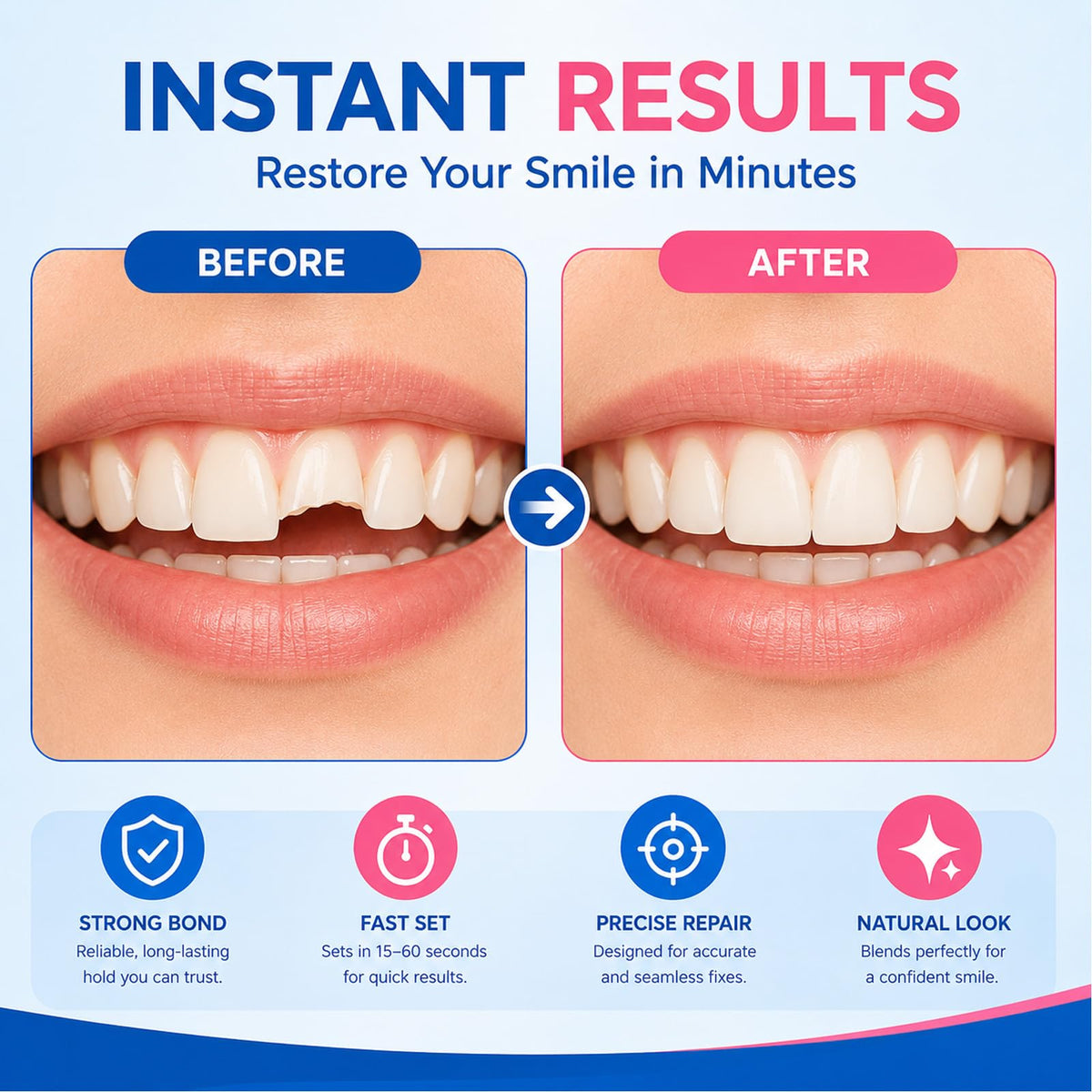Dental Lab Instant Bonding Dental Glue 1oz J737391
